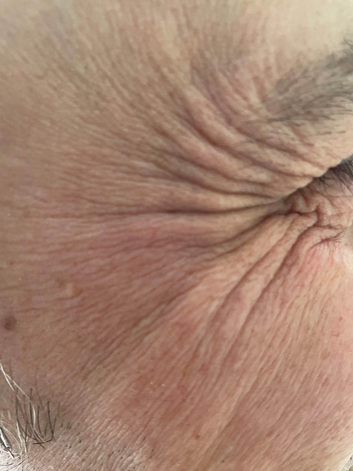 Treatment result