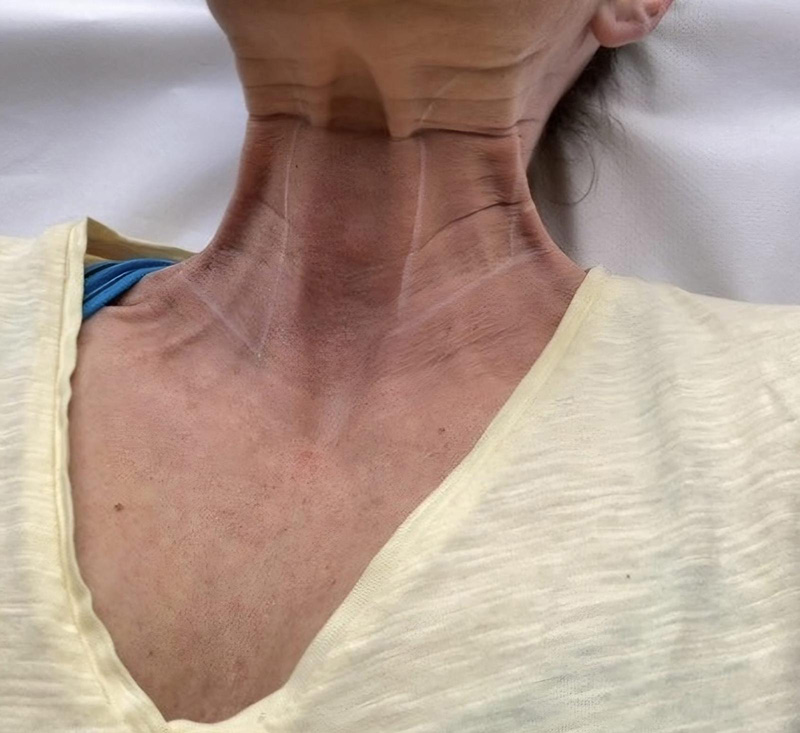 Patient 2 – Before treatment